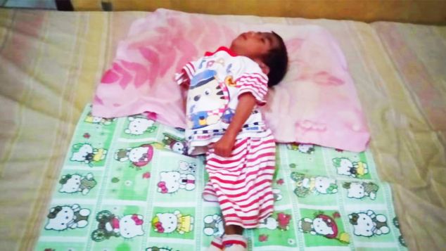 Latif, Penderita Cerebal Palsy & Gizi Buruk
