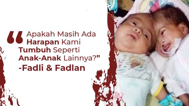 Bantu Operasi Pemisahan Kepala Fadli dan Fadlan