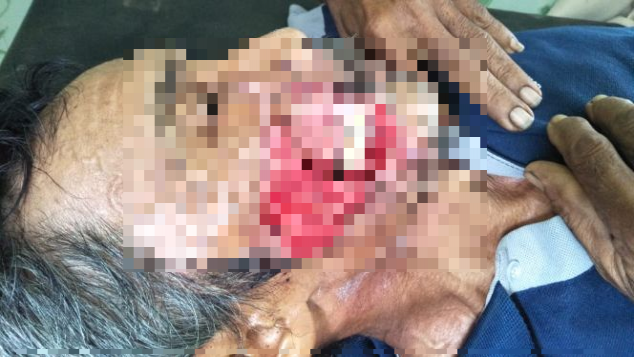 Bantuan untuk pengobatan penyakit tumor ganas bpk