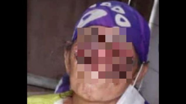 Bantu Ibu Abah Melawan Kanker