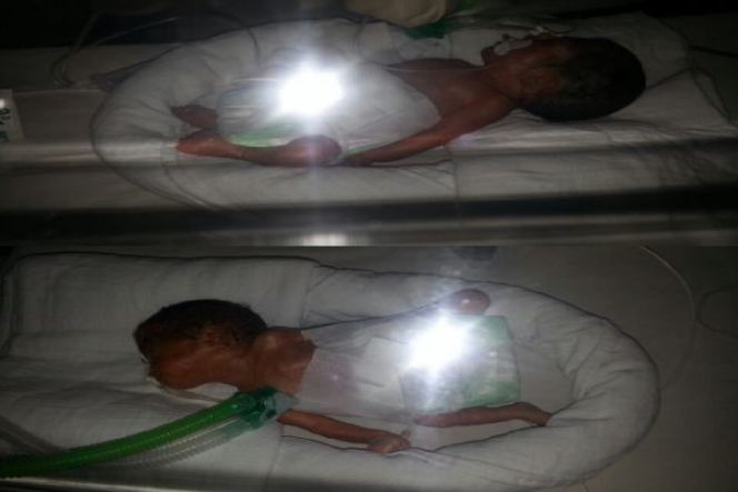 Bantu 2 Bayi Kembar Premature di NICU