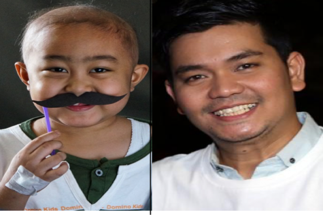 #BotakinBekti - Shave For Hope