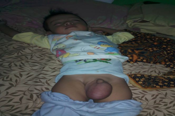 Peduli Azka