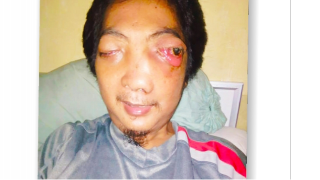 Bantu ayah melawan kanker nasofaring