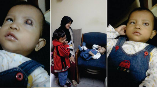 Bantu Balita Aisyah Berjuang Kesembuhan Mata