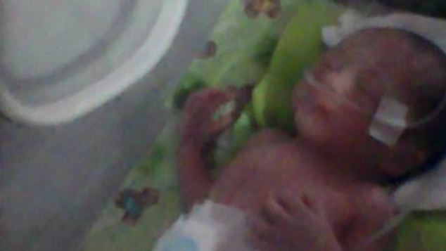 Bayi Cantik Syaqilla Prematur Butuh Bantuan