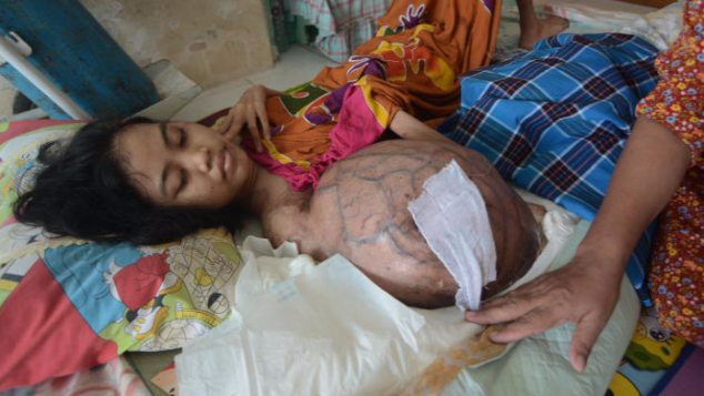 Diserang Kanker Ganas, Nurul Putus Sekolah