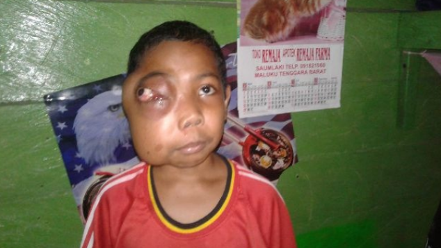 Bersama Adek Hendri, Melawan Tomor/Kanker Ganas.
