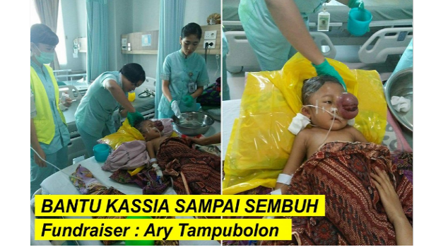 KASSIA BUTUH DANA OPERASI PENYAKIT LIFOMA STADIU4