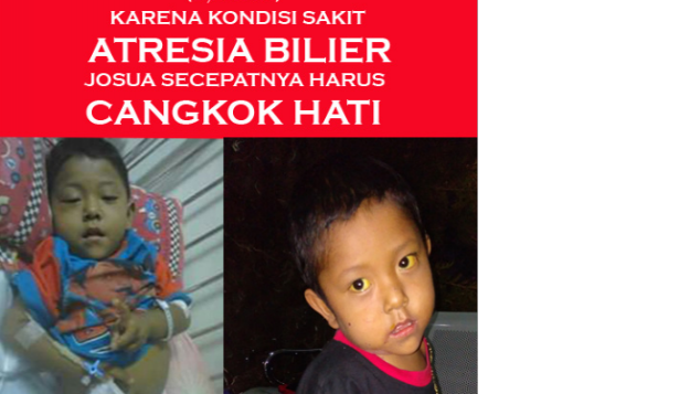 JOSUA HARUS CANGKOK HATI