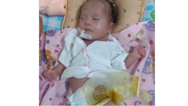AyoBantu Kesembuhan Jantung dan Anus Adik Sabrina