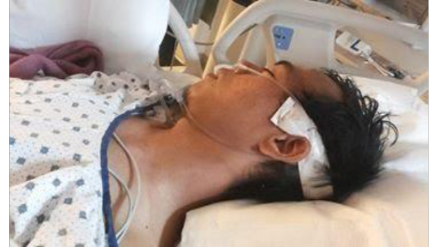 Bantu Penderita Tumor Otak di Tanah Rantau
