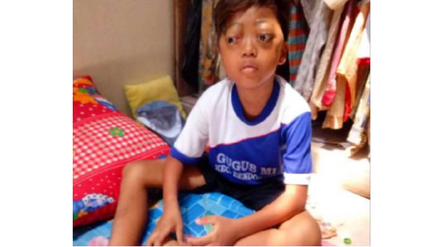 Ayo Bantu Fandy Operasi Tumor Mata