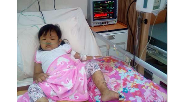 Doa untuk Hawa Operasi Lymphedema Ke Prancis