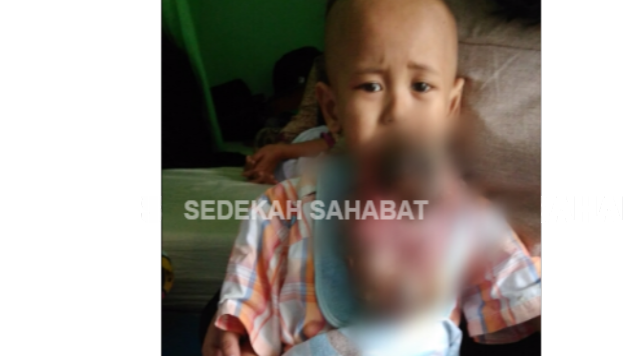 Bantu Saiful Sembuh dari Kanker Ganas