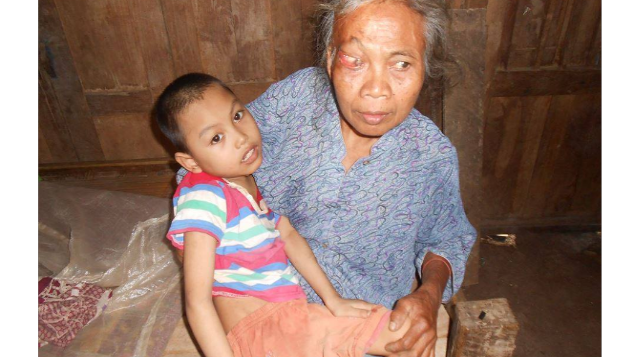bantu irfan melawan cerebral palsy