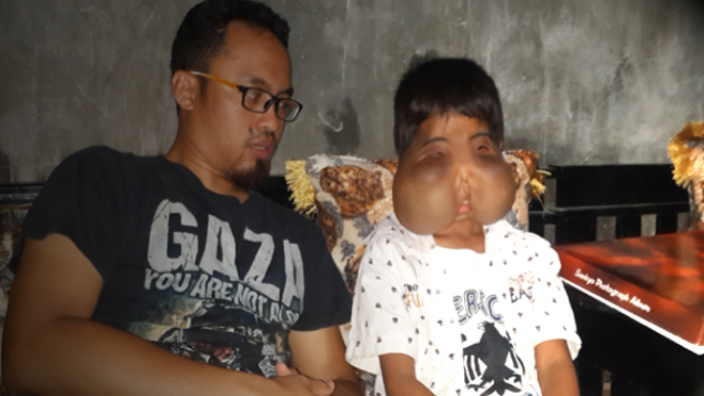 BANTU RIFkI TERSENYUM