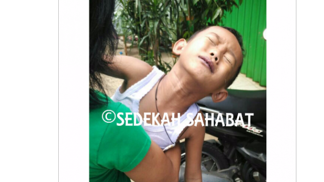 Bantu Rizky Untuk Operasi Jantung Bocor