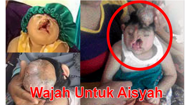 Wajah Untuk Aisyah