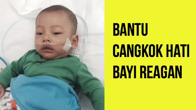 Bantu Cangkok Hati Bayi Reagan