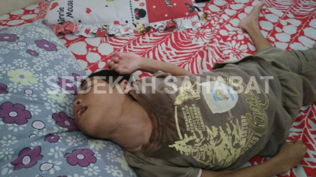 Bantu Aghil Melawan Cerebral Palsy