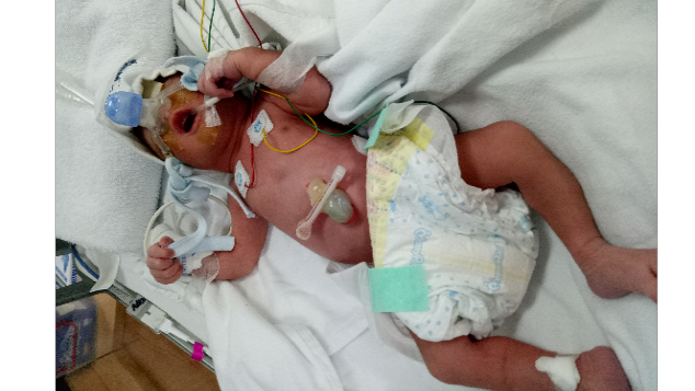 Bantu Baby Jehan yang sedang dalam perawatan NICU