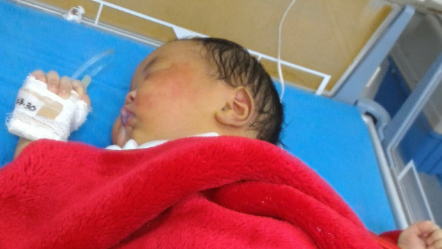 Biaya Pengobatan Jantung Bocor Bayi Ny.Tiana