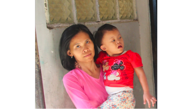 Agni, si Bungsu down Syndrome butuh uluran Anda!