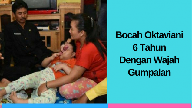 Bocah Oktaviani, 6 Tahun Dengan Gumpalan di Wajah