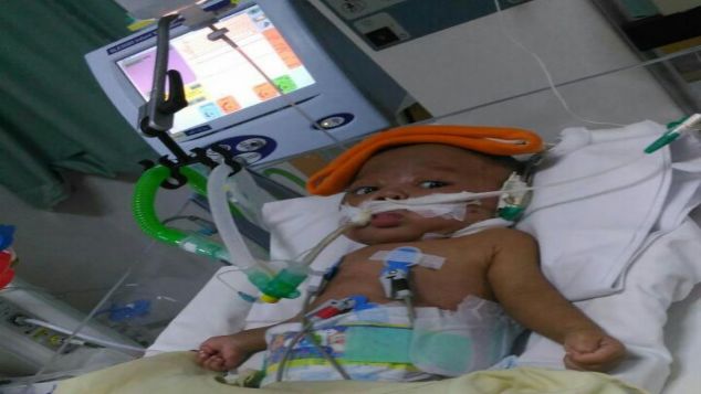 Bantu ARYA BISMA lepas dari ventilator