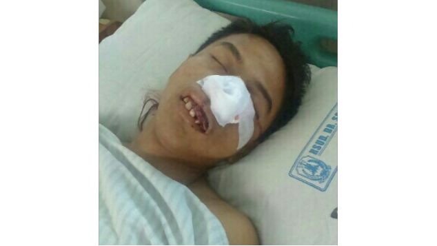 Operasi Tumor Kawan Kami "Muhammad Yasin"