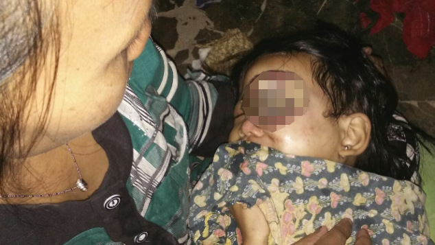Bantu ZHIQRA AIDILA penderita kanker mata
