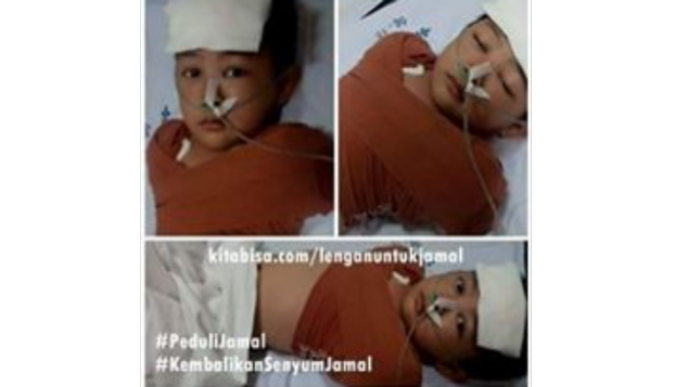 LENGAN UNTUK JAMAL