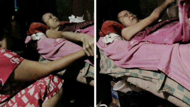 Bantu Shanty Mengobati Kanker Tulang