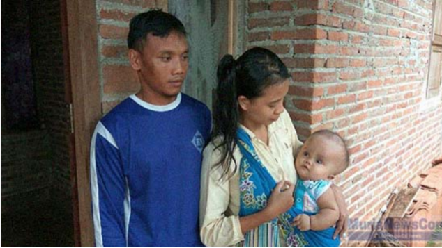 Bantu Isna Zulfa Rahmadani Operasi Hidrosefalus