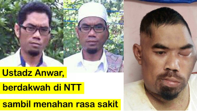 Ustadz Anwar berdakwah di NTT sambil menahan sakit
