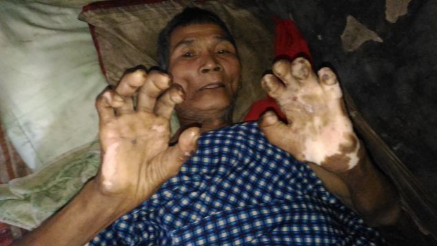 Bantu Mbah Tobri kembali Sehat