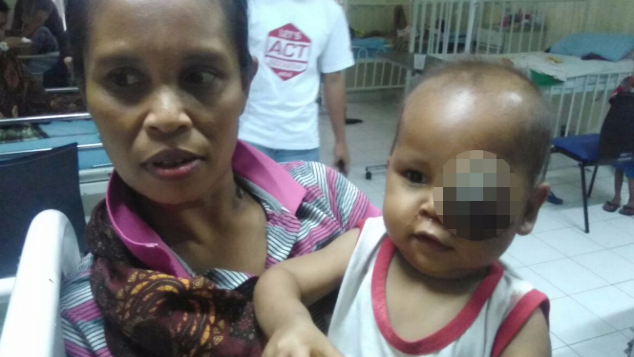 Bantu Pengobatan Tumor Mata Adik Piki