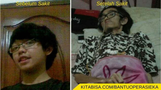 Bantu Operasi Eka