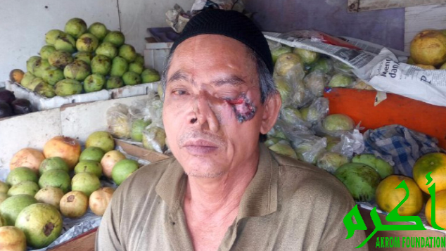 Bantu Operasi Pak Rojak