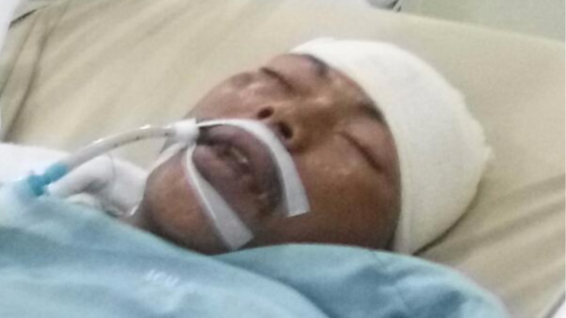 Bantu Operasi Batok Kepala Rionas