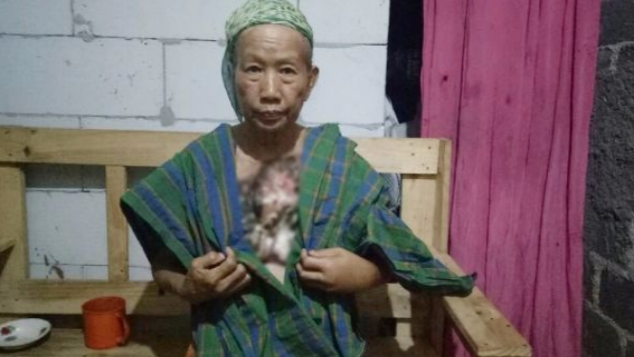 Nenek Solimah, Dhuafa Penderita Kanker Payudara