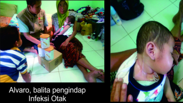BANTU SELAMATKAN ALVARO DARI INFEKSI JAMUR OTAK