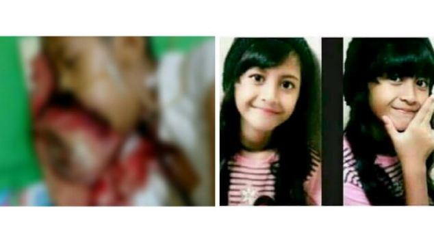 Peduli Tania | Kanker Mulut