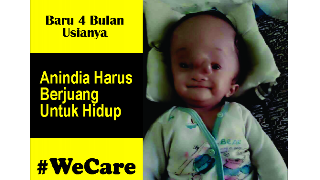 Bayi Baru 4 Bulan Harus Berjuang Untuk Hidup