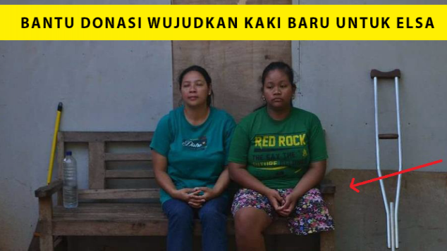 "Kaki Baru" Untuk Elsa Si Calon Dokter Anak
