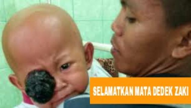 Bantu Dedek Zaki Ngeliat Normal Lagi