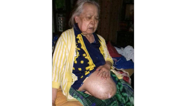 Turun Peranakan, Bantu Biaya Operasi Bu Rohanah