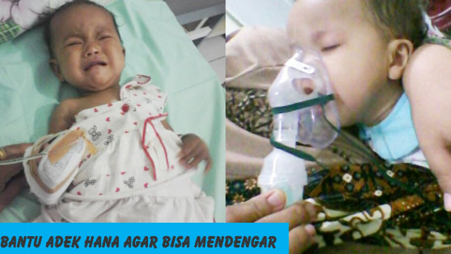 BANTU ADEK HANA AGAR BISA MENDENGAR