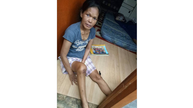 Bantu Ibu Enti Sembuh Dari Infeksi Tulang Kaki